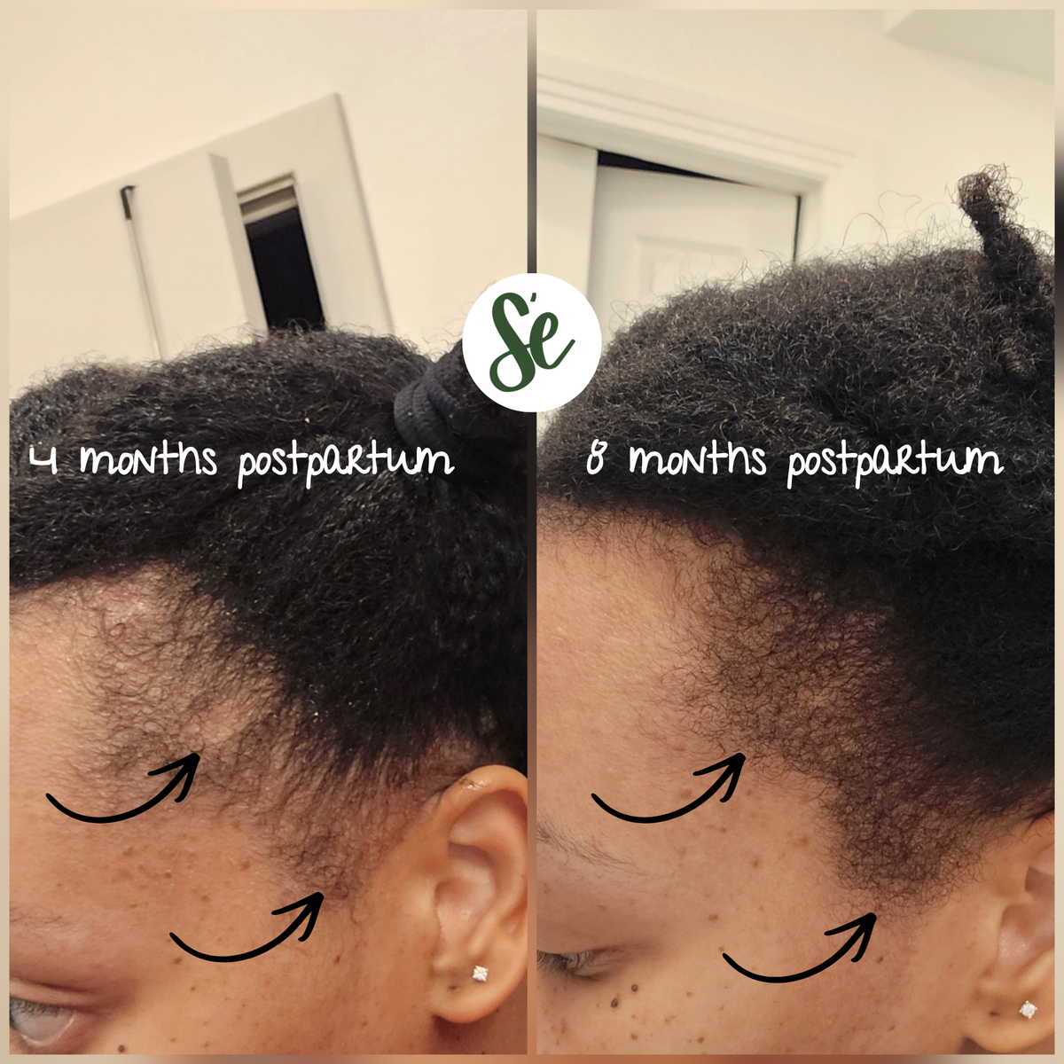 Organic Hair Growth Serum - Sonia's Eden